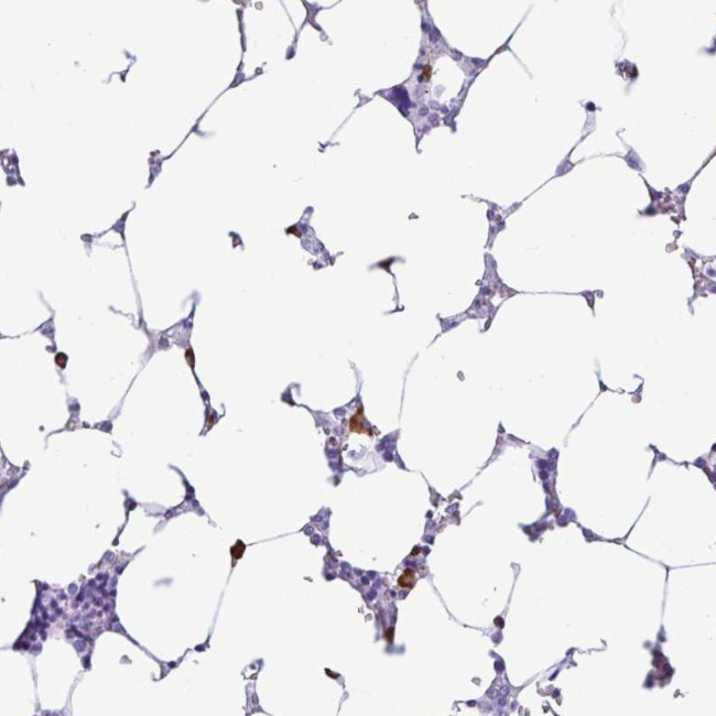 PIGF Antibody in Immunohistochemistry (Paraffin) (IHC (P))