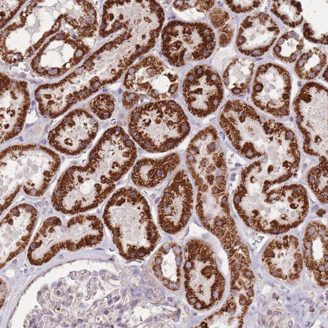 CNOT8 Antibody in Immunohistochemistry (Paraffin) (IHC (P))