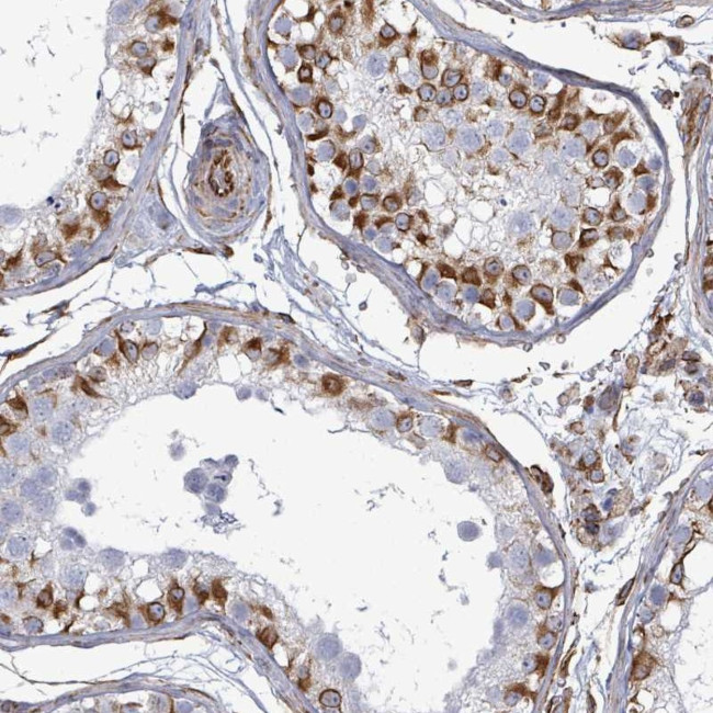 AGAP1 Antibody in Immunohistochemistry (Paraffin) (IHC (P))