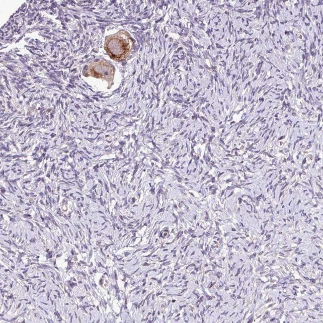 TTLL3 Antibody in Immunohistochemistry (IHC)