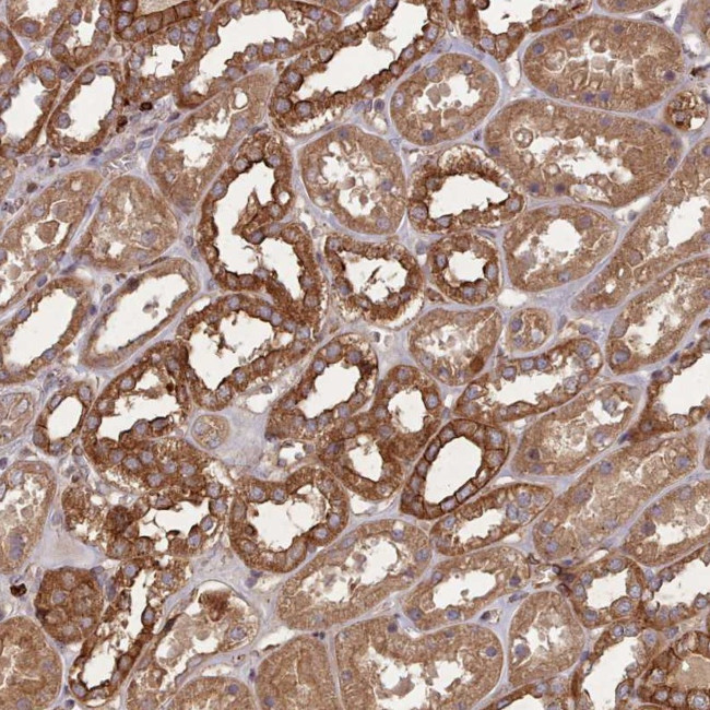 THSD7B Antibody in Immunohistochemistry (Paraffin) (IHC (P))