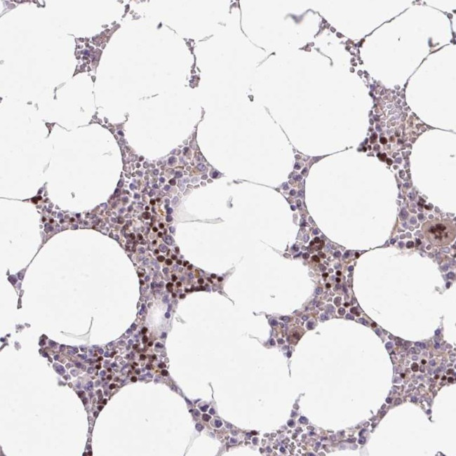 ZNF394 Antibody in Immunohistochemistry (Paraffin) (IHC (P))