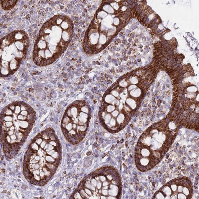 ALKBH4 Antibody in Immunohistochemistry (Paraffin) (IHC (P))