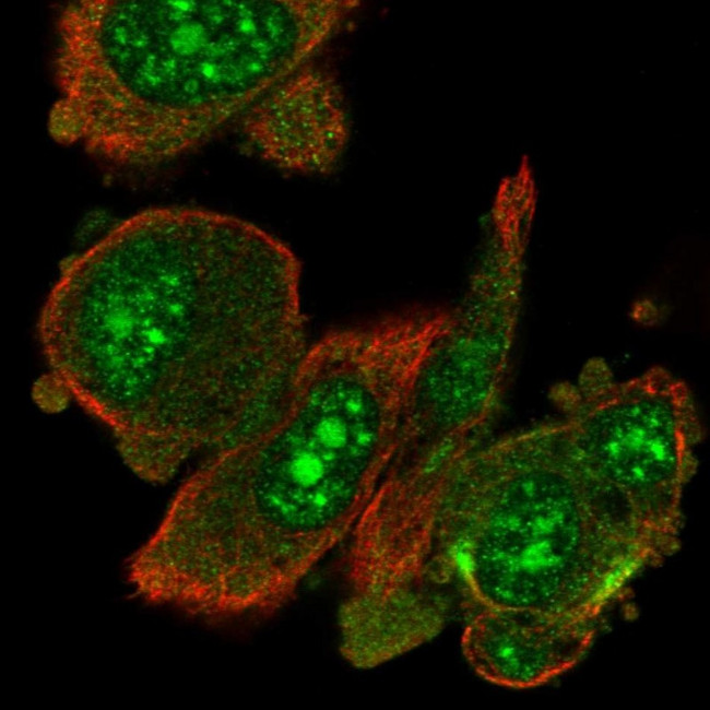 RIOK1 Antibody in Immunocytochemistry (ICC/IF)