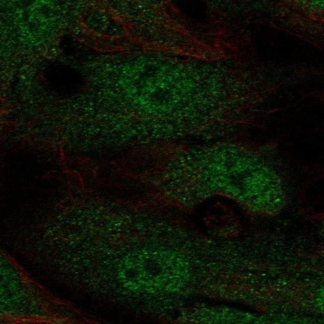 Annexin 2 Receptor Antibody in Immunocytochemistry (ICC/IF)