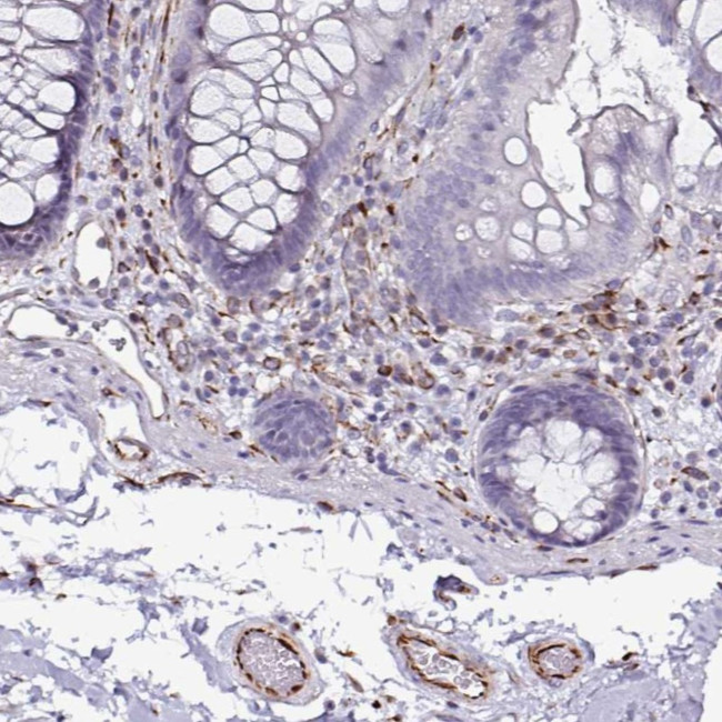 TMPRSS9 Antibody in Immunohistochemistry (Paraffin) (IHC (P))
