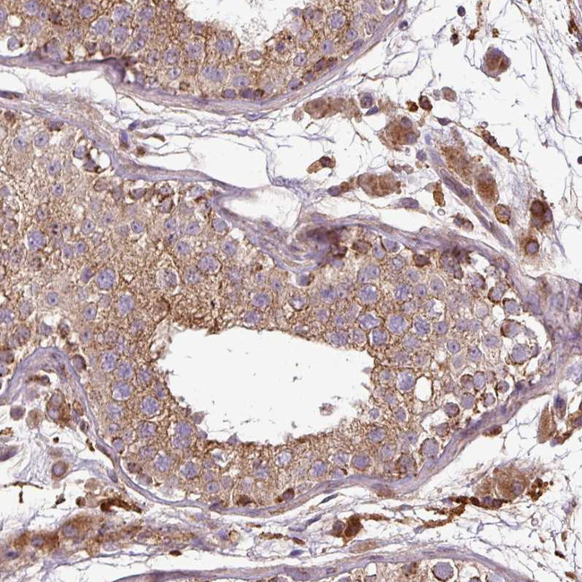 ZNF513 Antibody in Immunohistochemistry (Paraffin) (IHC (P))