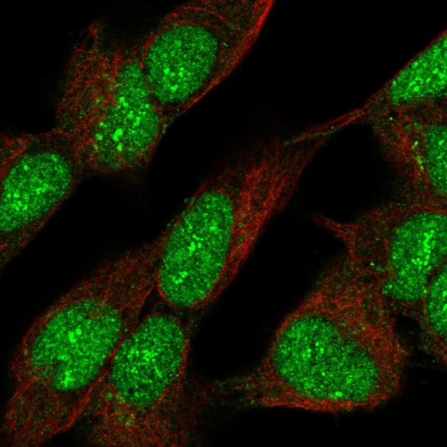 ZNF280C Antibody in Immunocytochemistry (ICC/IF)