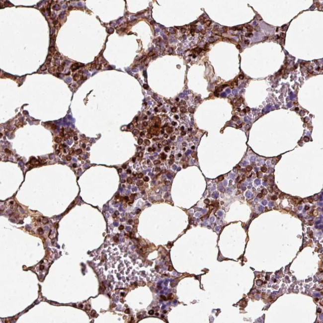 TMEFF1 Antibody in Immunohistochemistry (Paraffin) (IHC (P))