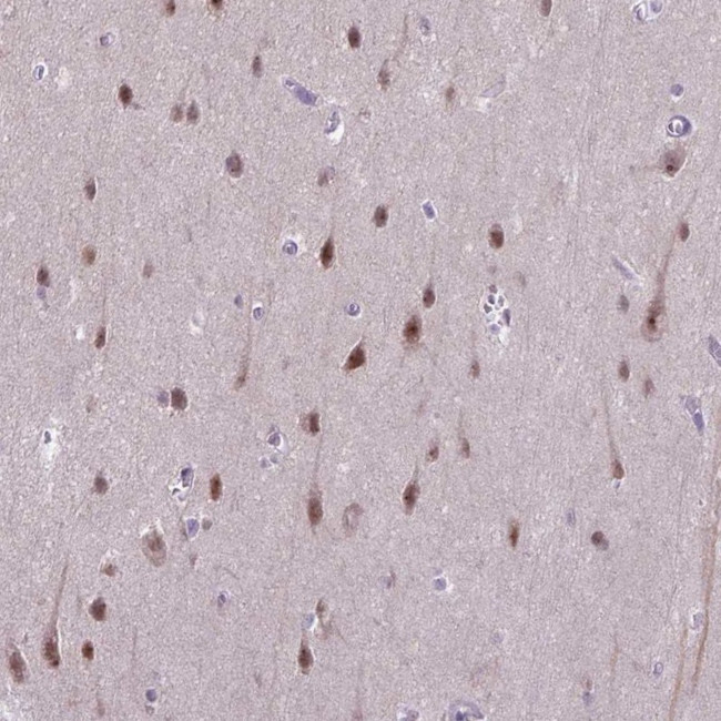 TCEAL7 Antibody in Immunohistochemistry (Paraffin) (IHC (P))