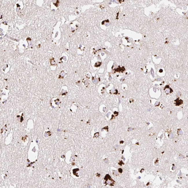 CLEC3A Antibody in Immunohistochemistry (Paraffin) (IHC (P))