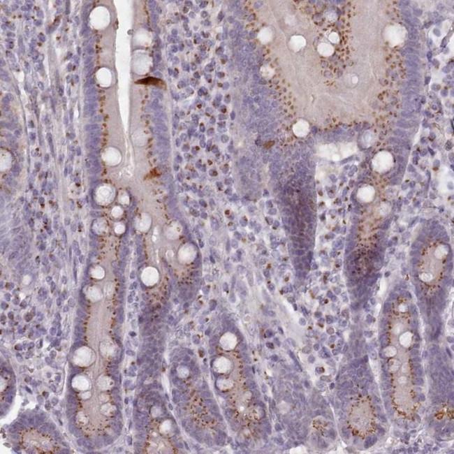 MAN1B1 Antibody in Immunohistochemistry (IHC)
