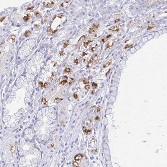 KCNE2 Antibody in Immunohistochemistry (Paraffin) (IHC (P))