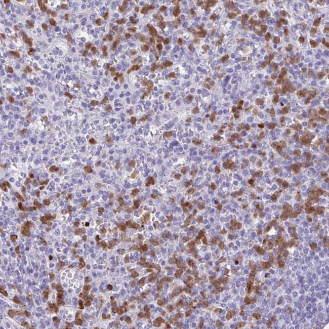 CEP120 Antibody in Immunohistochemistry (Paraffin) (IHC (P))