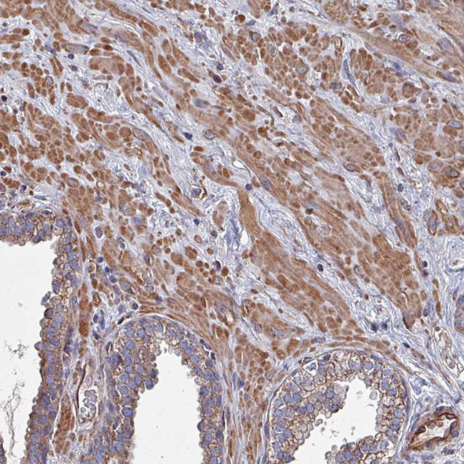 TMEM16K Antibody in Immunohistochemistry (Paraffin) (IHC (P))