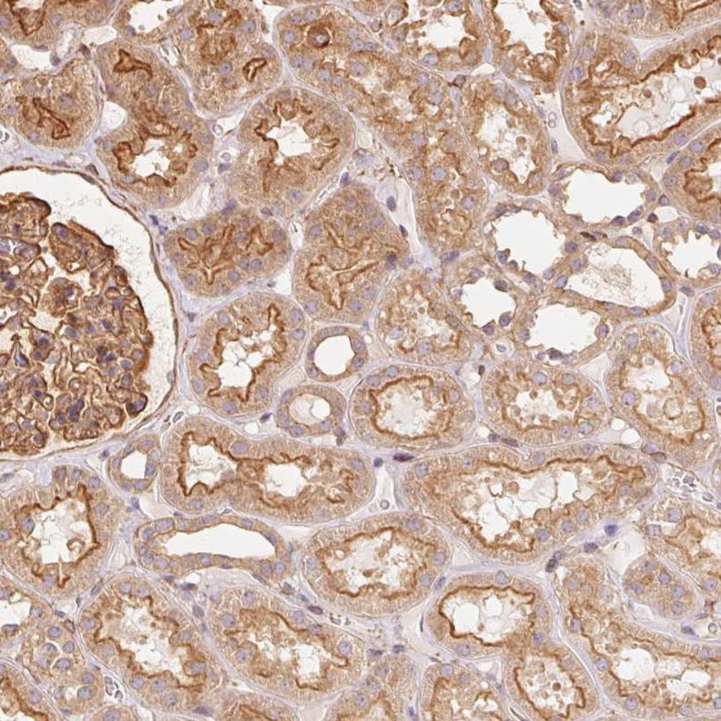 FRAS1 Antibody in Immunohistochemistry (Paraffin) (IHC (P))