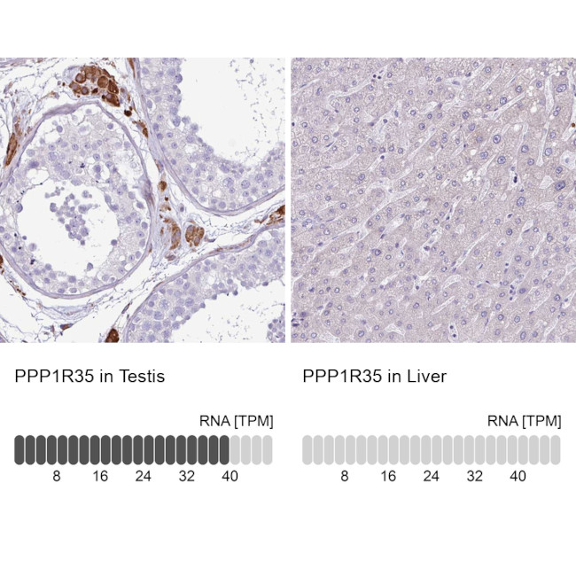 PPP1R35 Antibody in Immunohistochemistry (IHC)