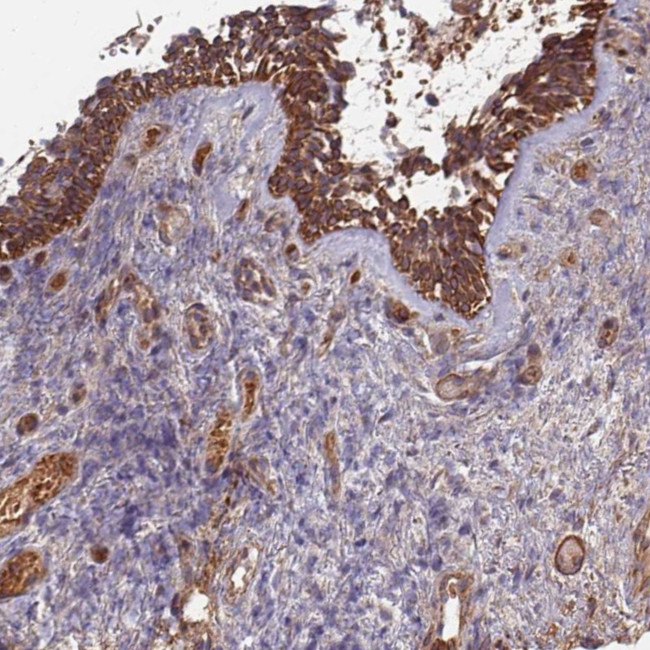 C4BPB Antibody in Immunohistochemistry (Paraffin) (IHC (P))