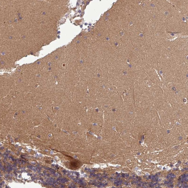 PUS1 Antibody in Immunohistochemistry (Paraffin) (IHC (P))