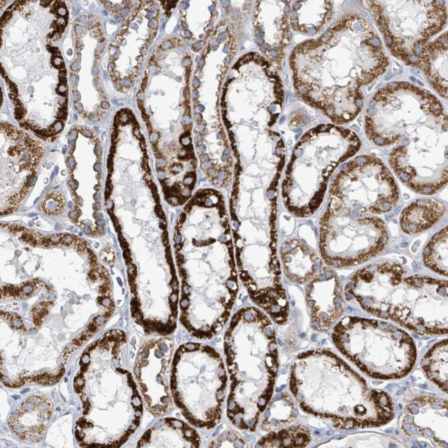ALG12 Antibody in Immunohistochemistry (Paraffin) (IHC (P))