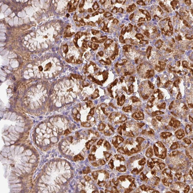 STK35 Antibody in Immunohistochemistry (Paraffin) (IHC (P))