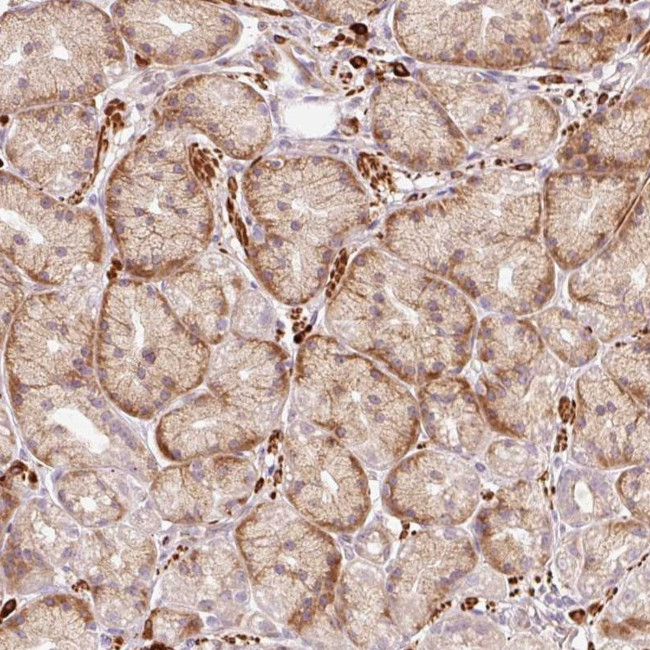 RANBP2 Antibody in Immunohistochemistry (Paraffin) (IHC (P))