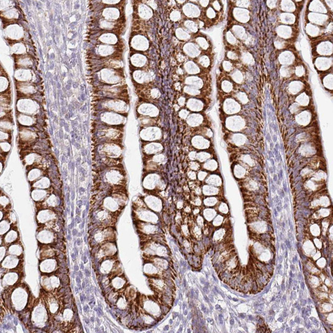 HMCN1 Antibody in Immunohistochemistry (Paraffin) (IHC (P))