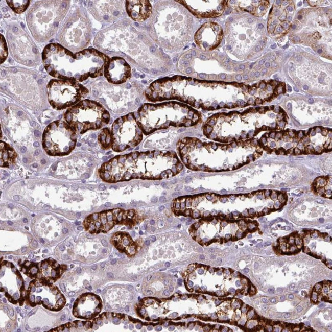 PRAMEF7 Antibody in Immunohistochemistry (Paraffin) (IHC (P))
