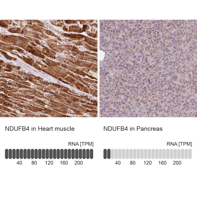 NDUFB4 Antibody in Immunohistochemistry (IHC)