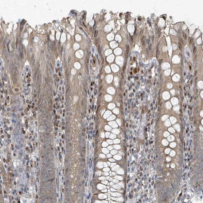 RHPN2 Antibody in Immunohistochemistry (IHC)