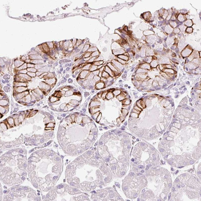 ANKRD20A4 Antibody in Immunohistochemistry (Paraffin) (IHC (P))