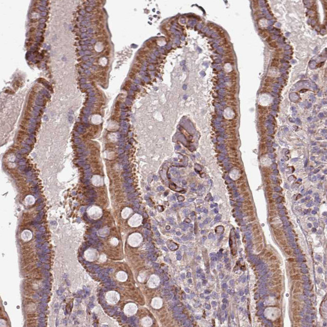 RPL23A Antibody in Immunohistochemistry (Paraffin) (IHC (P))