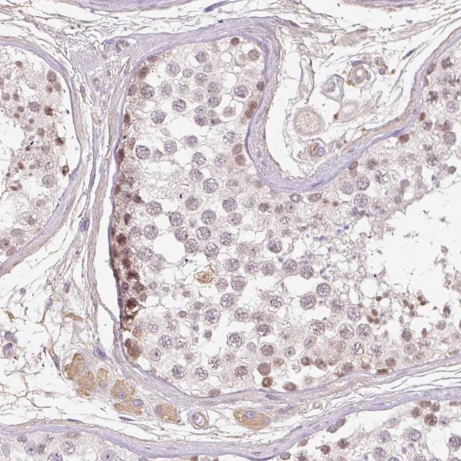 TDRD15 Antibody in Immunohistochemistry (Paraffin) (IHC (P))