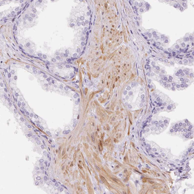 Smoothelin Antibody in Immunohistochemistry (Paraffin) (IHC (P))