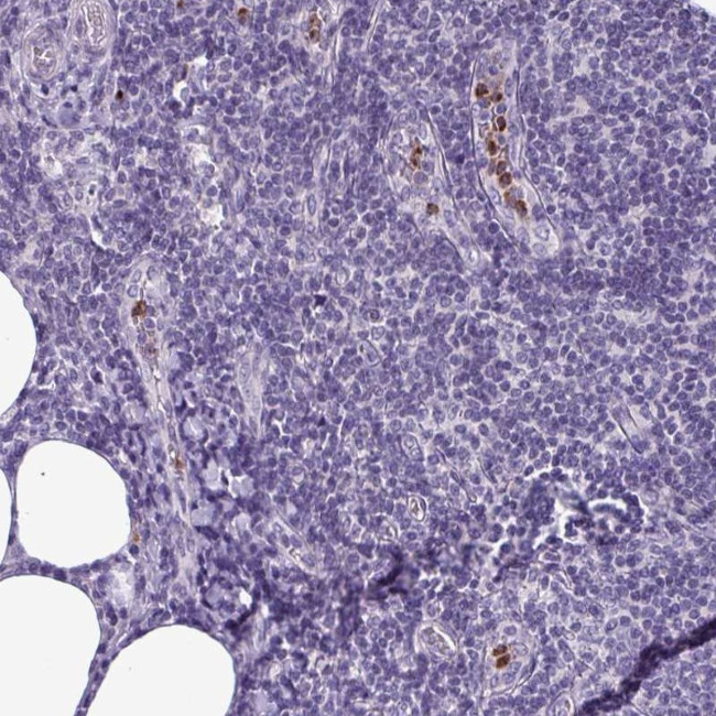 TMEM11 Antibody in Immunohistochemistry (Paraffin) (IHC (P))