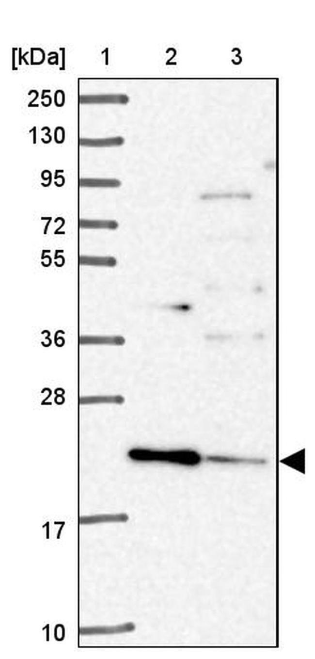 TMEM11 Antibody in Western Blot (WB)