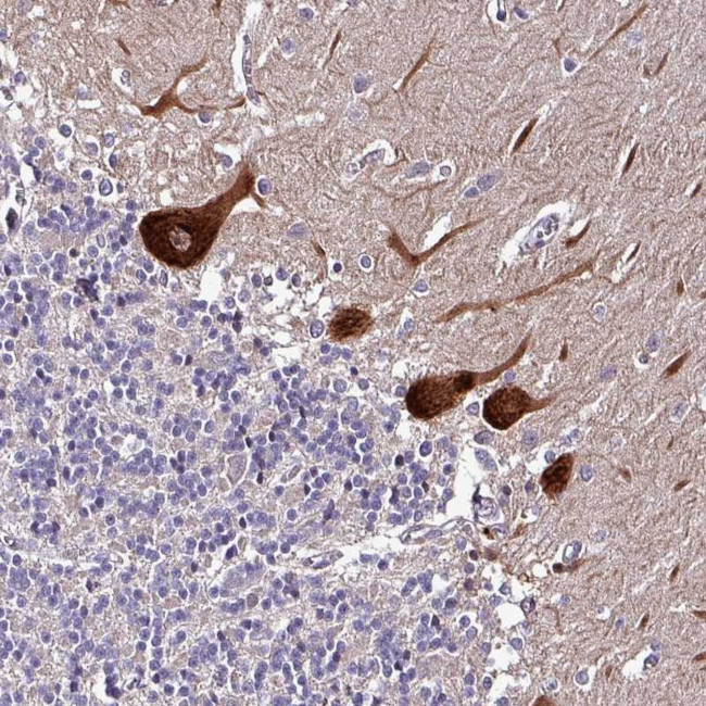 GRAPL Antibody in Immunohistochemistry (Paraffin) (IHC (P))