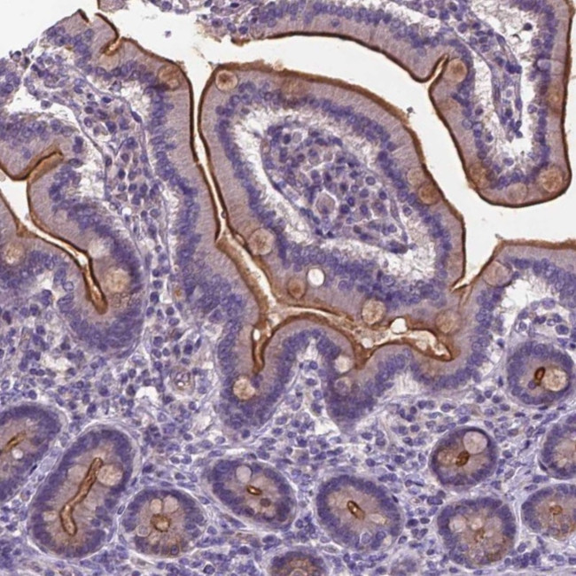 T4S20 Antibody in Immunohistochemistry (Paraffin) (IHC (P))