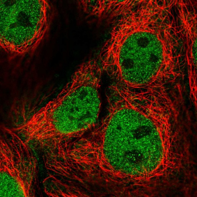FAM222B Antibody in Immunocytochemistry (ICC/IF)