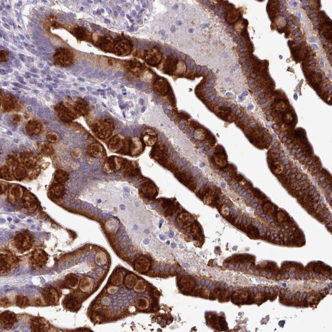 TOR1AIP2 Antibody in Immunohistochemistry (IHC)