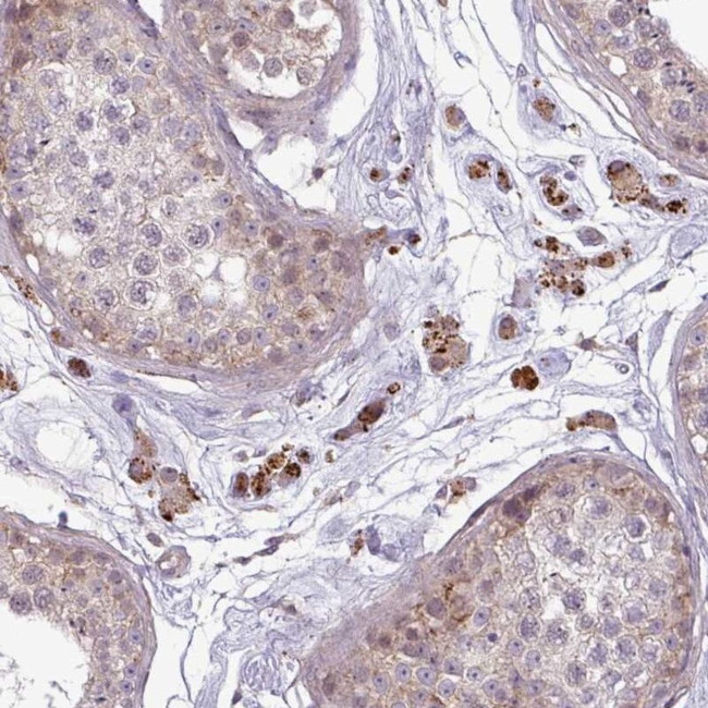 ZNF35 Antibody in Immunohistochemistry (IHC)