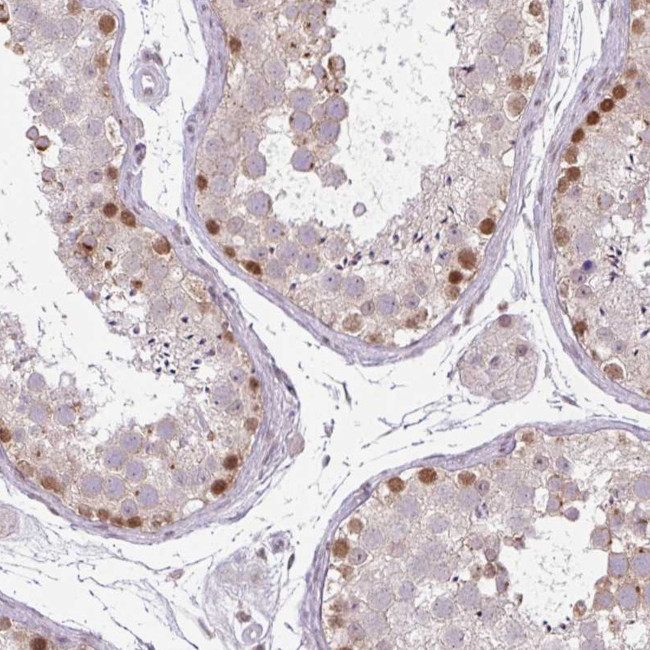 CHTF8 Antibody in Immunohistochemistry (Paraffin) (IHC (P))