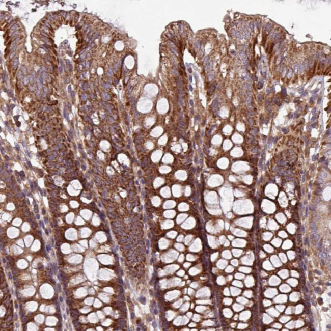PLEKHD1 Antibody in Immunohistochemistry (Paraffin) (IHC (P))