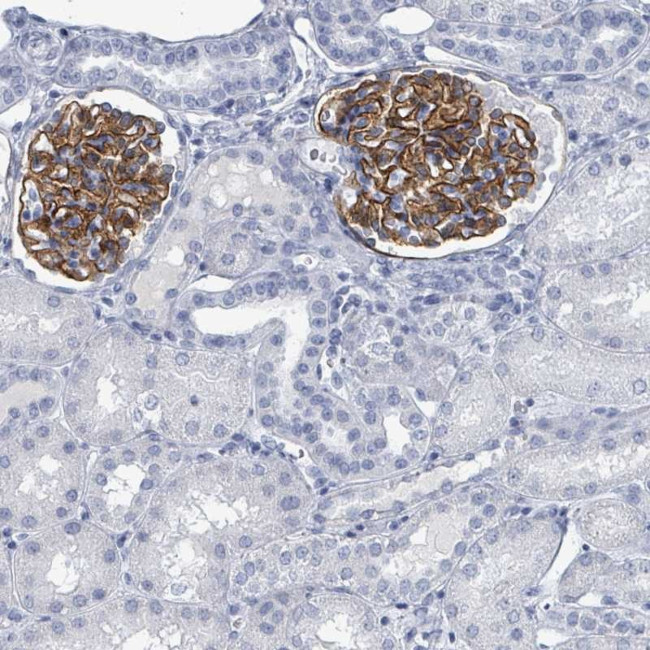 TAS2R1 Antibody in Immunohistochemistry (Paraffin) (IHC (P))