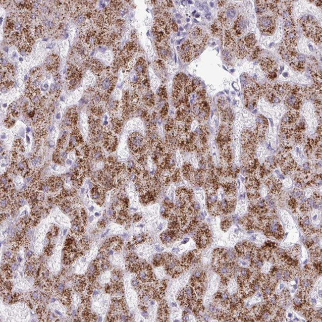 ANKRD13B Antibody in Immunohistochemistry (Paraffin) (IHC (P))