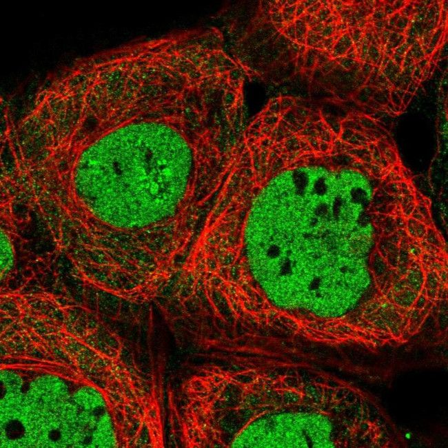 ALG8 Antibody in Immunocytochemistry (ICC/IF)