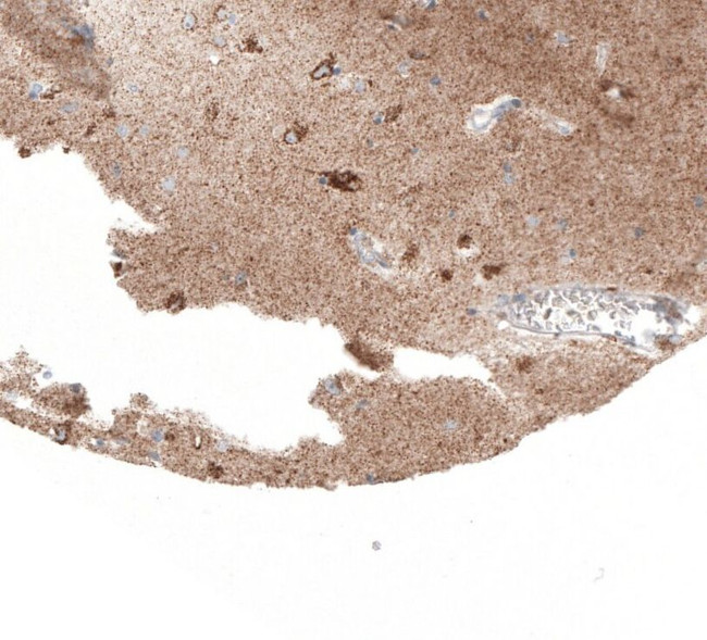 SERPINE3 Antibody in Immunohistochemistry (IHC)