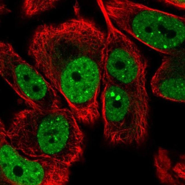 LRRC41 Antibody in Immunocytochemistry (ICC/IF)