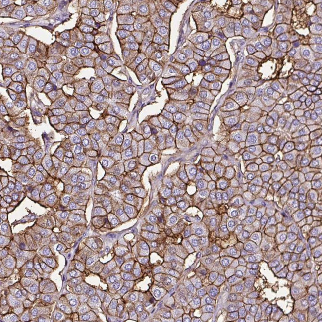 SLC7A8 Antibody in Immunohistochemistry (Paraffin) (IHC (P))