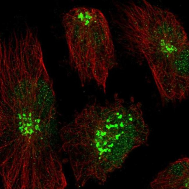 RHBDD2 Antibody in Immunocytochemistry (ICC/IF)